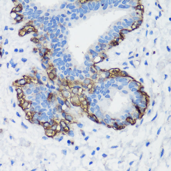 Filamin A Rabbit Polyclonal Antibody - Image 3