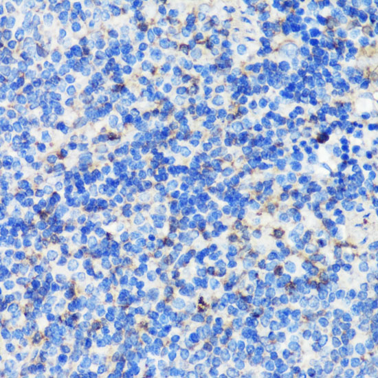 Filamin A Rabbit Polyclonal Antibody - Image 4