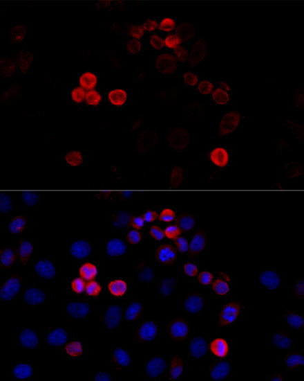 Filamin A Rabbit Polyclonal Antibody - Image 5