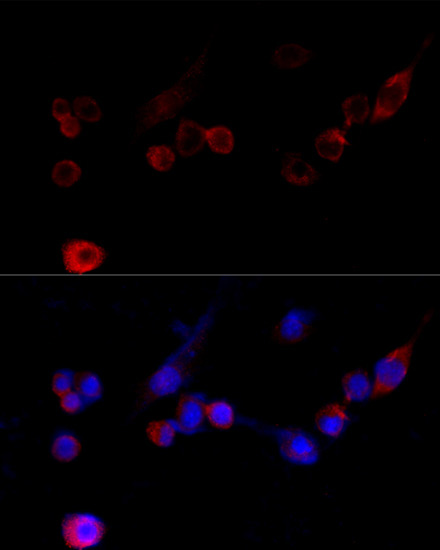 Filamin A Rabbit Polyclonal Antibody - Image 6