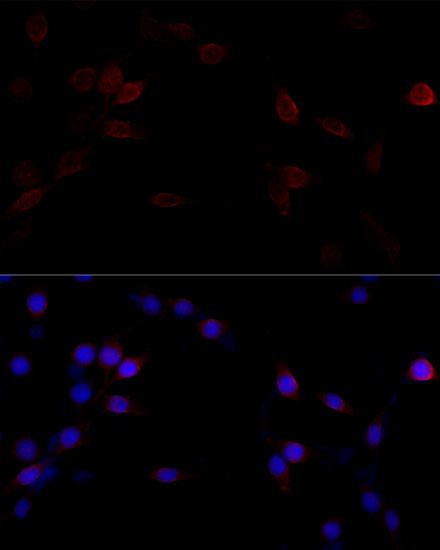 Filamin A Rabbit Polyclonal Antibody - Image 7