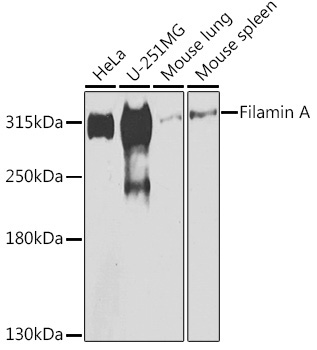 Filamin A Rabbit Polyclonal Antibody