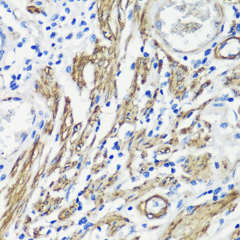 Filamin A Rabbit Polyclonal Antibody - Image 2