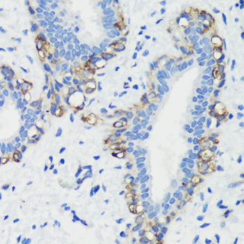 Filamin A Rabbit Polyclonal Antibody - Image 3
