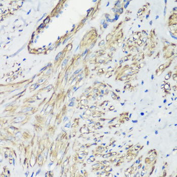 Filamin A Rabbit Polyclonal Antibody - Image 4