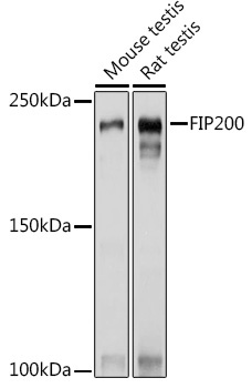 FIP200 Rabbit Polyclonal Antibody