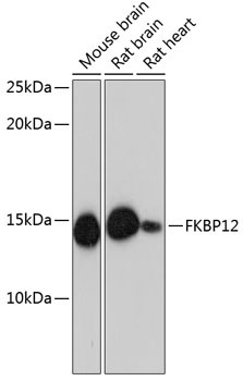 FKBP12 Rabbit Monoclonal Antibody