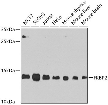FKBP2 Rabbit Polyclonal Antibody