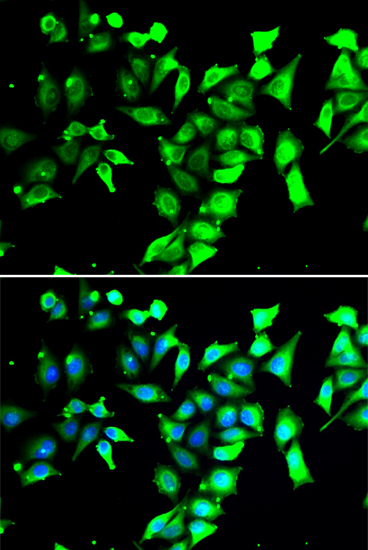 FKBP38/FKBP8 Rabbit Polyclonal Antibody - Image 2