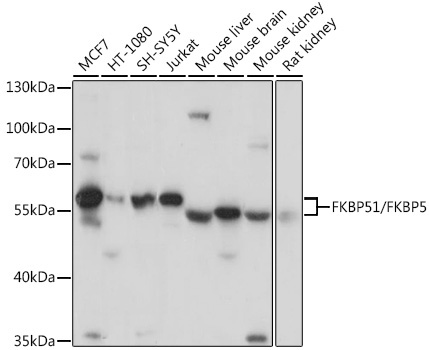 FKBP51/FKBP5 Rabbit Polyclonal Antibody