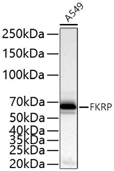 FKRP Rabbit Polyclonal Antibody - Image 2