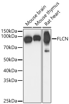 FLCN Rabbit Polyclonal Antibody