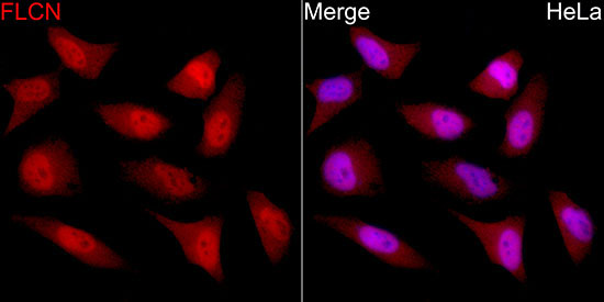 FLCN Rabbit Polyclonal Antibody - Image 2