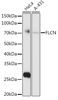 FLCN Rabbit Polyclonal Antibody