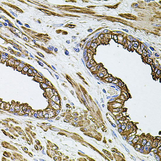 FLNB Rabbit Polyclonal Antibody - Image 4