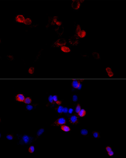 FLNB Rabbit Polyclonal Antibody - Image 5
