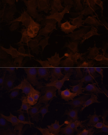 FLNB Rabbit Polyclonal Antibody - Image 6