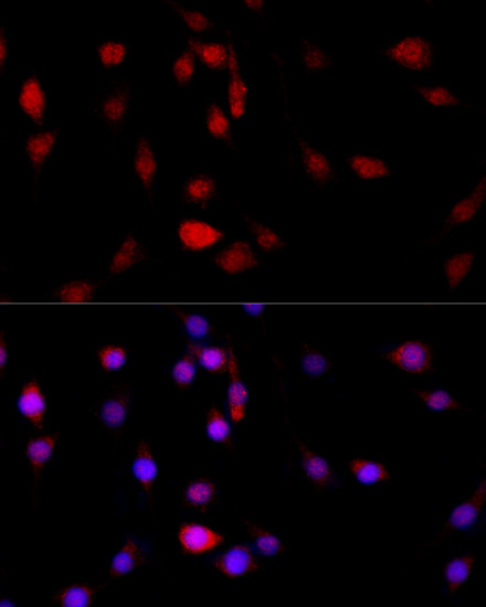 FLNB Rabbit Polyclonal Antibody - Image 8