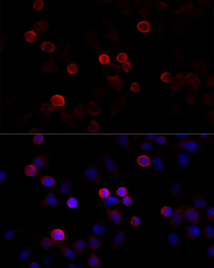 FLNC Rabbit Polyclonal Antibody - Image 2
