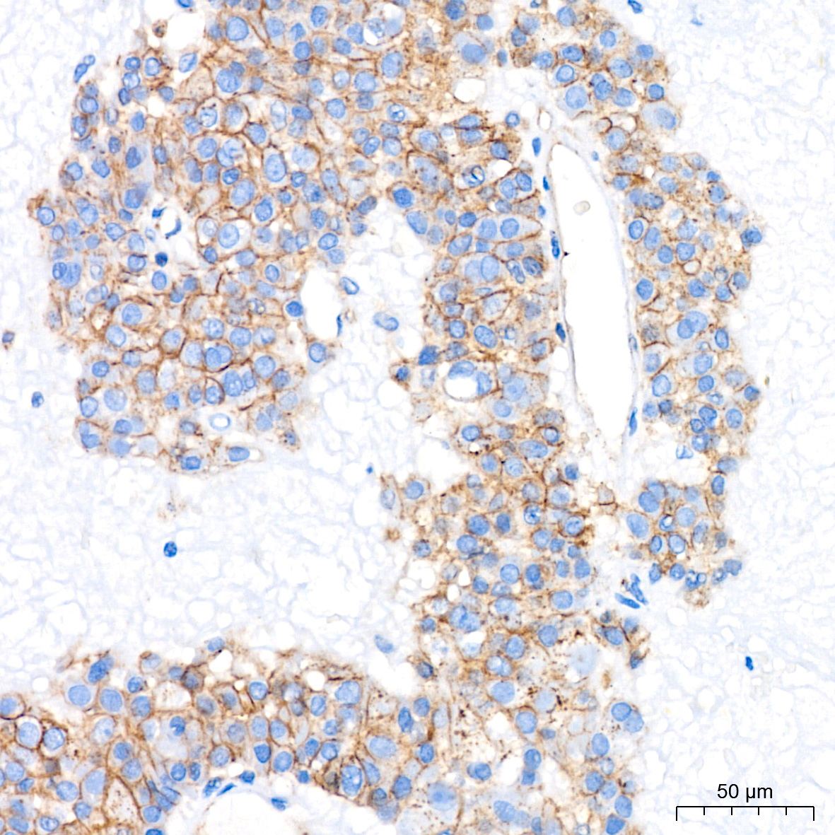 Flotillin 1 Rabbit Monoclonal Antibody - Image 3
