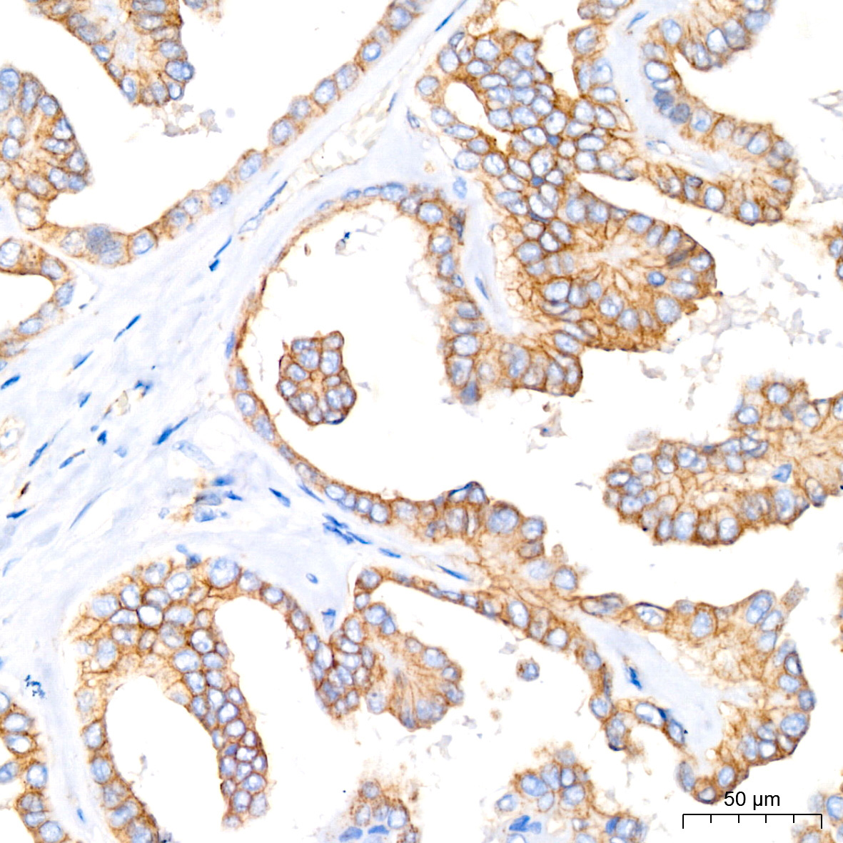 Flotillin 1 Rabbit Monoclonal Antibody - Image 4