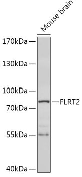 FLRT2 Rabbit Polyclonal Antibody