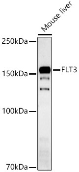 FLT3 Rabbit Polyclonal Antibody