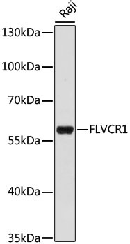 FLVCR1 Rabbit Polyclonal Antibody