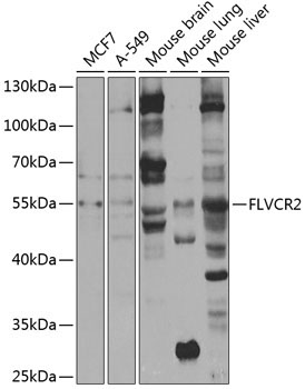 FLVCR2 Rabbit Polyclonal Antibody