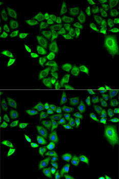 FMO3 Rabbit Polyclonal Antibody - Image 2