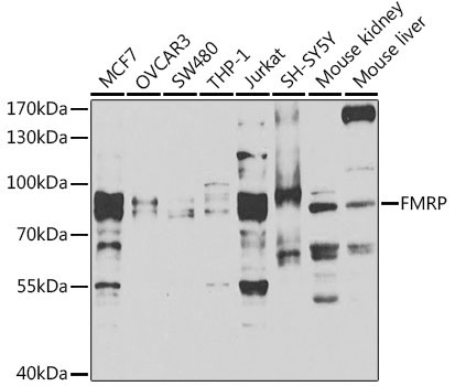 FMRP Rabbit Polyclonal Antibody