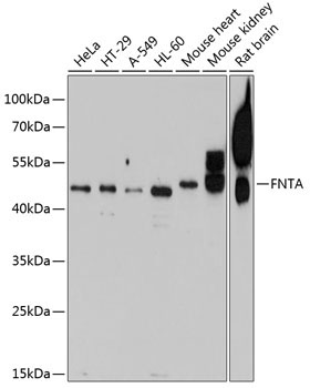FNTA Rabbit Polyclonal Antibody