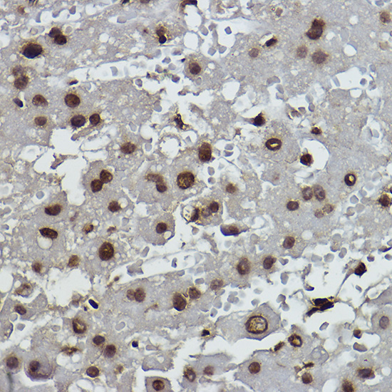 Formyl-Histone H2B-K19,400 Rabbit Monoclonal Antibody