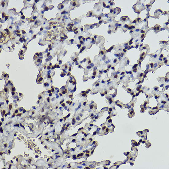Formyl-Histone H2B-K19,400 Rabbit Monoclonal Antibody - Image 2