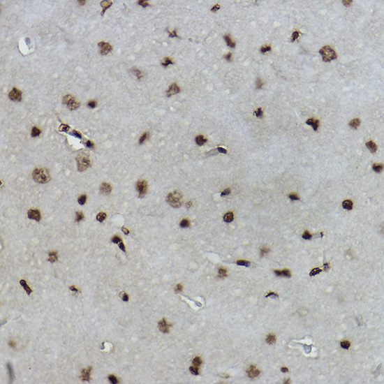 Formyl-Histone H2B-K19,400 Rabbit Monoclonal Antibody - Image 3