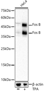 Fos B Rabbit Monoclonal Antibody