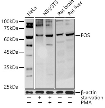 FOS Rabbit Polyclonal Antibody