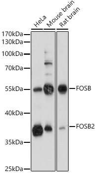 FOSB Rabbit Polyclonal Antibody