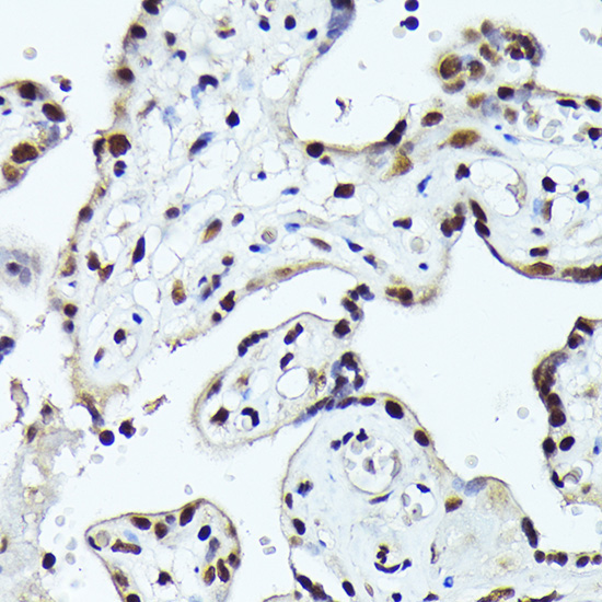 FOSB Rabbit Polyclonal Antibody - Image 2