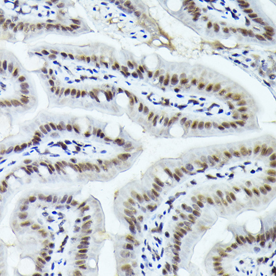 FOSB Rabbit Polyclonal Antibody - Image 3