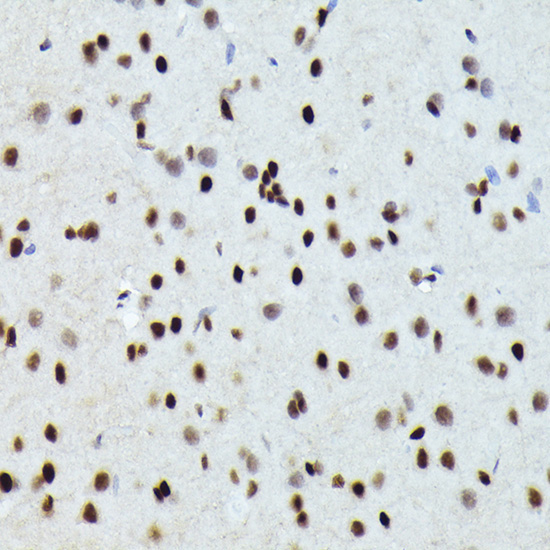 FOSB Rabbit Polyclonal Antibody - Image 4