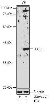 FOSL1 Rabbit Polyclonal Antibody