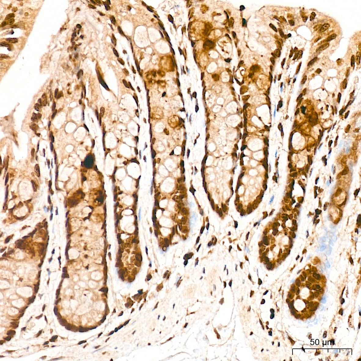 FOSL2/FRA2 Rabbit Polyclonal Antibody