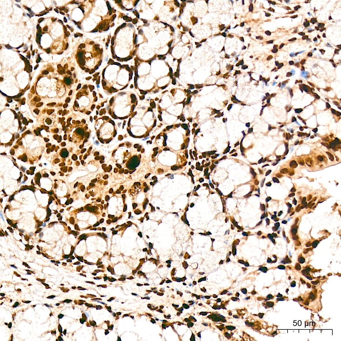 FOSL2/FRA2 Rabbit Polyclonal Antibody - Image 2