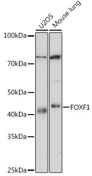 FOXF1 Rabbit Monoclonal Antibody