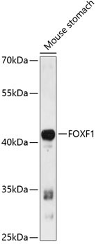 FOXF1 Rabbit Polyclonal Antibody