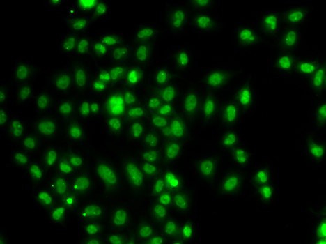 FOXN2 Rabbit Polyclonal Antibody