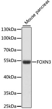 FOXN3 Rabbit Polyclonal Antibody