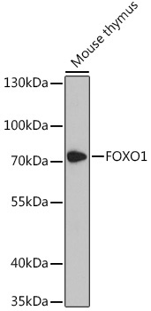 FOXO1 Rabbit Polyclonal Antibody