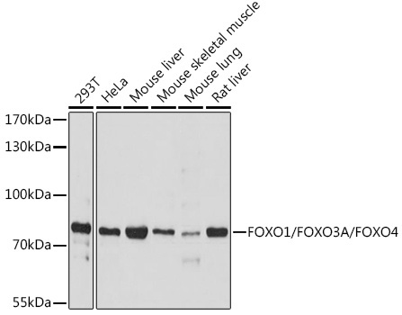 FOXO1/FOXO3A/FOXO4 Rabbit Polyclonal Antibody